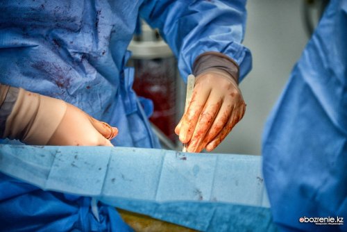 Павлодарские врачи впервые прооперировали ребенка с синдромом Гольденхара